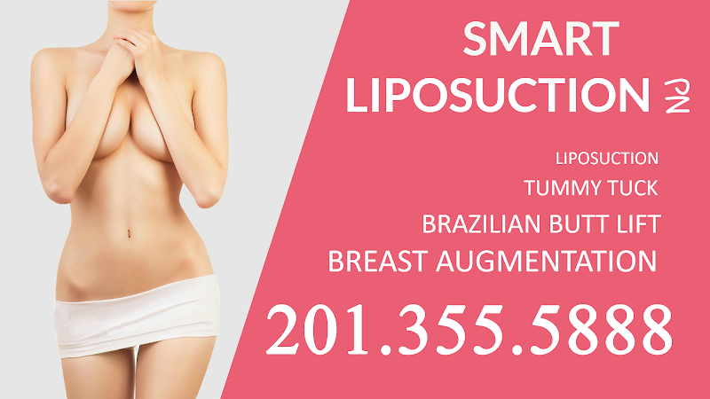 Smart Liposuction NJ